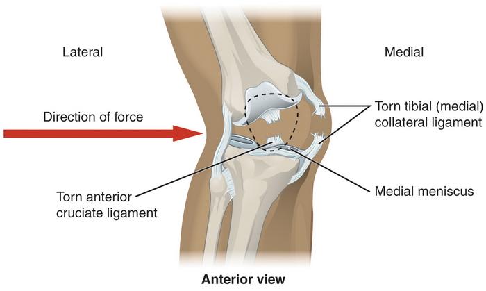 918_Knee_Injury.jpg