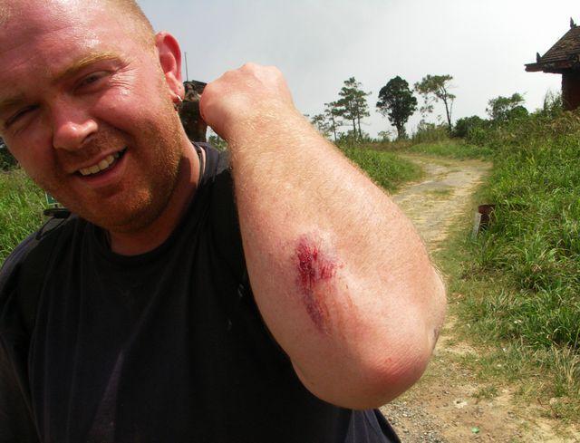 bokor-unfall.jpg